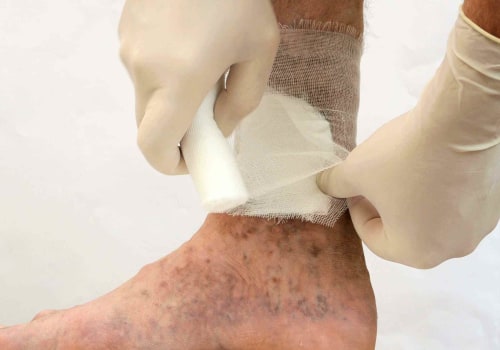 Purulent Drainage: Understanding Its Characteristics and Treatment