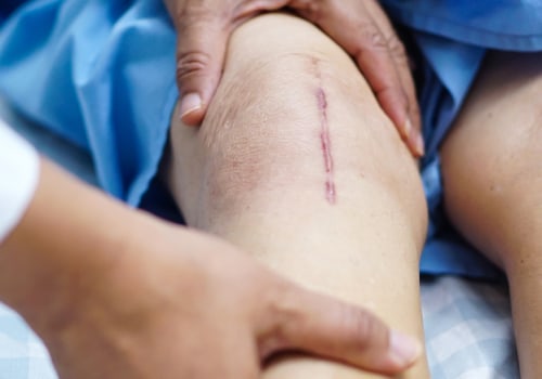 Faster Healing Starts Here: Phases of Wound Healing You Should Know